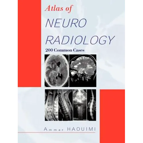 Atlas of Neuroradiology: 200 Common Cases - Paperback