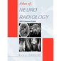 Atlas of Neuroradiology: 200 Common Cases - Paperback