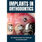 Implants in Orthodontics - Paperback