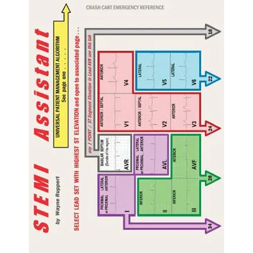 STEMI Assistant - Paperback