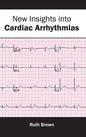 New Insights Into Cardiac Arrhythmias - Hardcover