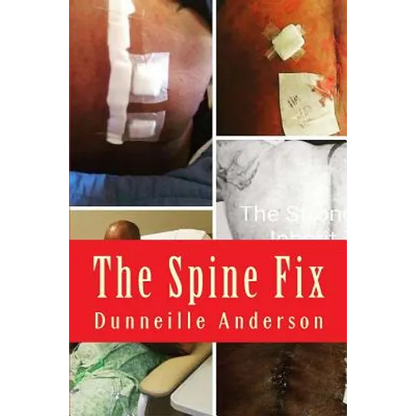 The Spine Fix: Life lessons on overcoming spinal surgery and improving your quality of life - Paperback