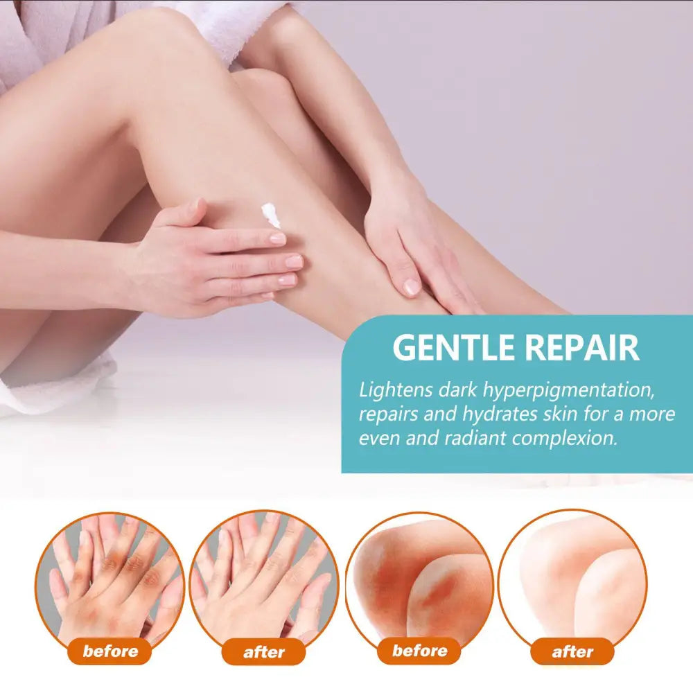 Black Echinacea Repair Cream for Body Whitening