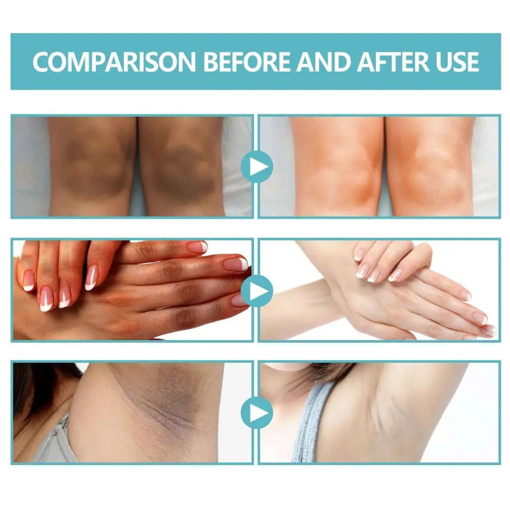 Black Echinacea Repair Cream for Body Whitening