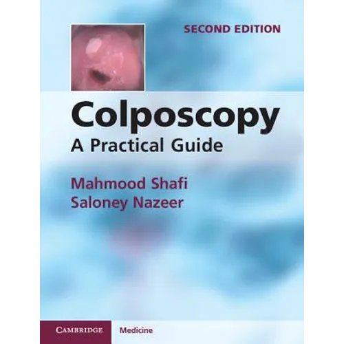 Colposcopy - Paperback