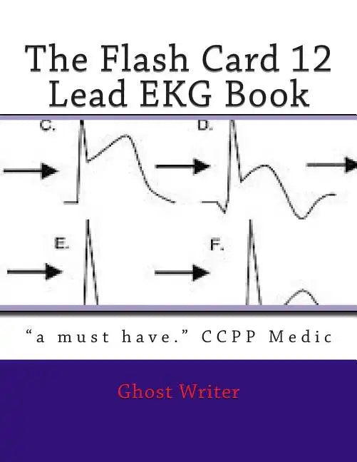 The Flash Card 12 Lead EKG - Paperback