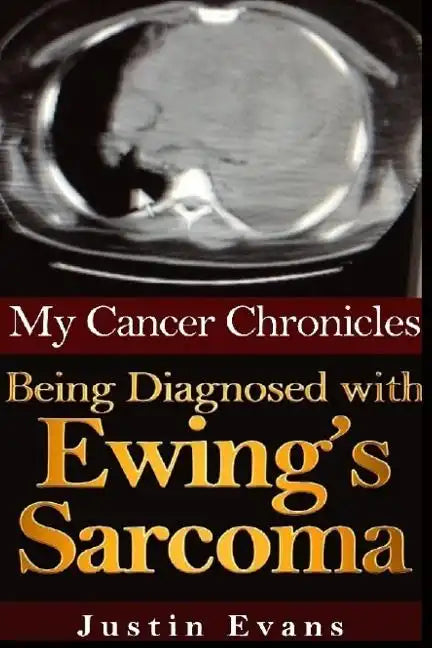 My Cancer Chronicles: Being Diagnosed with Ewing's Sarcoma - Paperback