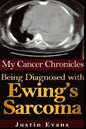 My Cancer Chronicles: Being Diagnosed with Ewing's Sarcoma - Paperback