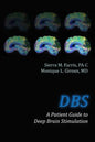 DBS a Patient Guide to Deep Brain Stimulation - Paperback