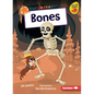 Bones - Paperback