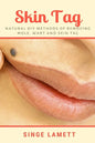 Skin Tag: Natural DIY Methods of removing Mole, Wart and Skin Tag - Paperback