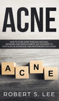 Acne: How to Cure Acne through Natural Remedies and Simple Habits. Say Goodbye to Pustules, Blackheads and Whiteheads for Good! - Hardcover