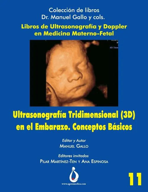 Ultrasonografia Tridimensional en el Embarazo (3D). Conceptos Básicos - Paperback