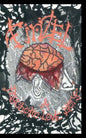 Finzel; a Psychotic Love Story - Paperback