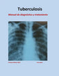 Tratamiento de Tuberculosis: Manual de diagnóstico y tratamiento - Paperback