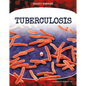 Tuberculosis - Library Binding