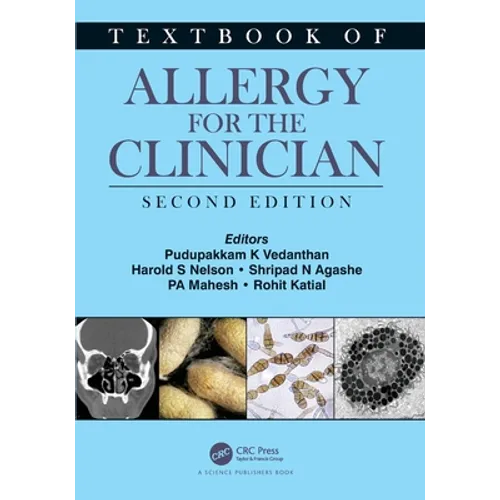 Textbook of Allergy for the Clinician - Paperback