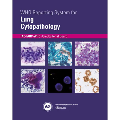 Who Reporting System for Lung Cytopathology - Paperback