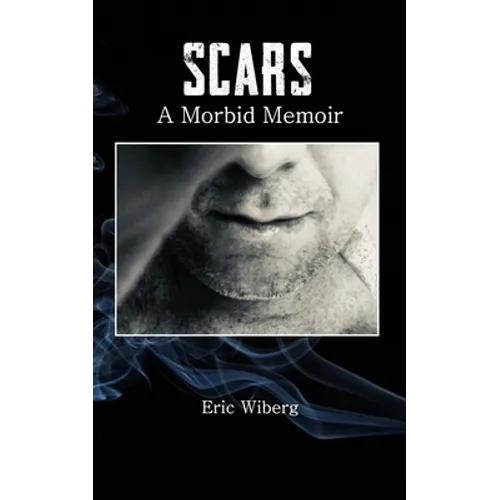 Scars: A Morbid Memoir - Paperback