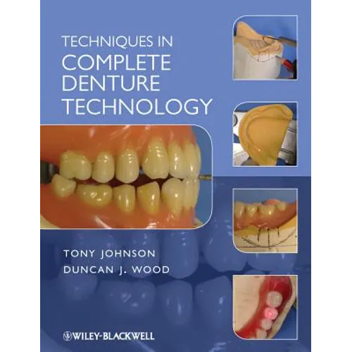 Techniques in Complete Denture - Paperback