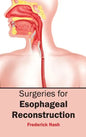 Surgeries for Esophageal Reconstruction - Hardcover