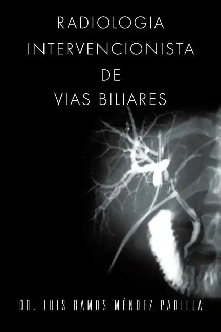 Radiologia Intervencionista de Vias Biliares - Paperback