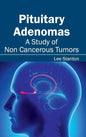 Pituitary Adenomas: A Study of Non Cancerous Tumors - Hardcover