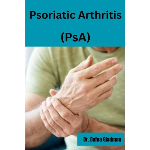Psoriatic Arthritis (PsA): Empowered Living: Your guide to wellness and hope with Psoriatic Arthritis - Paperback