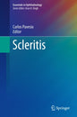 Scleritis - Hardcover