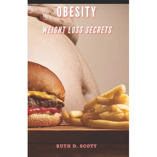 Obesity: Weight Loss Secrets - Paperback