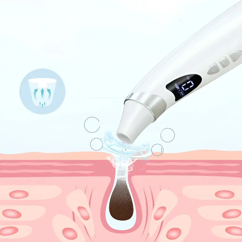 Electric Visual Blackhead Suction Pore Cleaner