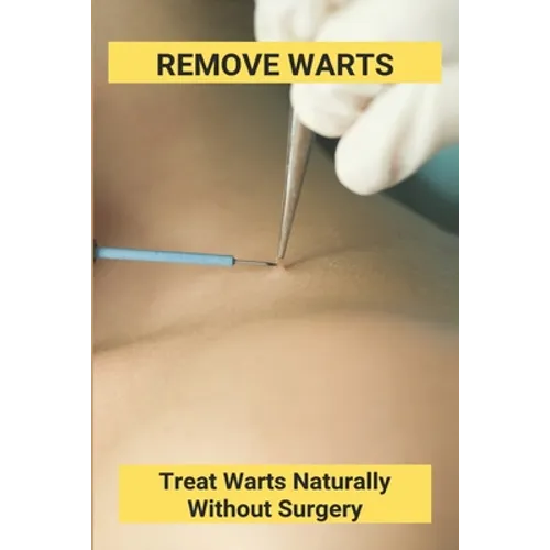 Remove Warts: Treat Warts Naturally Without Surgery: Boost Immune System To Get Rid Of Warts - Paperback