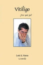 Vitiligo - Paperback
