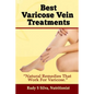 Best Varicose Vein Treatments: Natural Remedies That Work for Varicose - Paperback