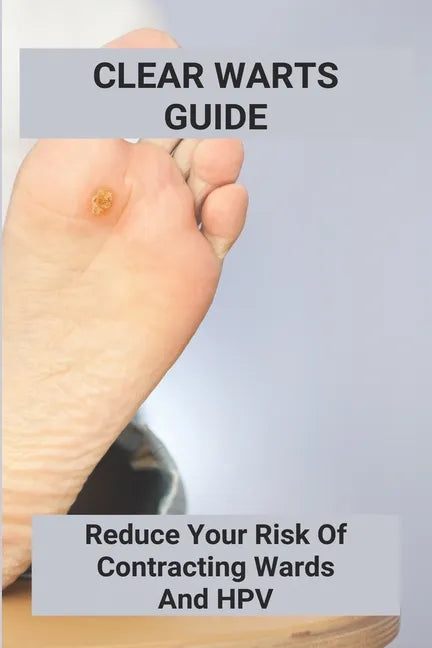 Clear Warts Guide: Reduce Your Risk Of Contracting Wards And Hpv: Does Duct Tape Get Rid Of Warts - Paperback