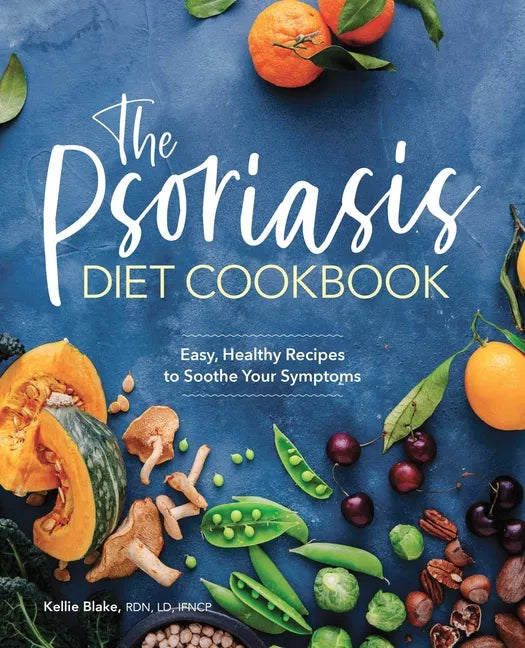 The Psoriasis Diet Cookbook: Easy, Healthy Recipes to Soothe Your Symptoms - Paperback