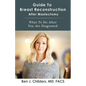 Guide To Breast Reconstruction After Mastectomy: What To Do After You Are Diagnosed - Paperback