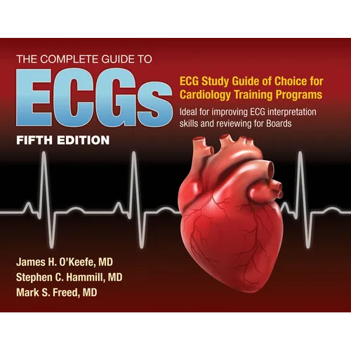 The Complete Guide to Ecgs: A Comprehensive Study Guide to Improve ECG Interpretation Skills: A Comprehensive Study Guide to Improve ECG Interpretatio - Paperback