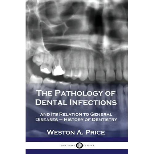 The Pathology of Dental Infections: and Its Relation to General Diseases - History of Dentistry - Paperback