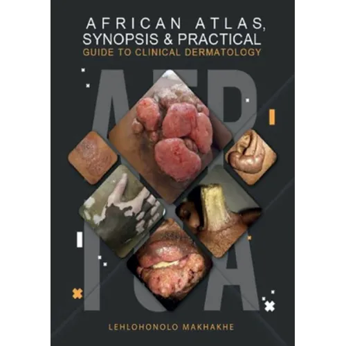 African Atlas, Synopsis & Practical Guide to Clinical Dermatology - Paperback