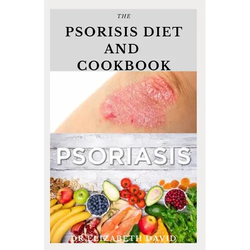 The Psoriasis Diet and Cookbook: Dietary Guide For Preventing and Healing Psoriasis: Includes Delicious Recipe, Meal Plan and Cookbook - Paperback