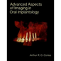 Advanced Aspects of Imaging in Oral Implantology - Paperback