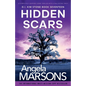Hidden Scars: A completely gripping crime thriller with a nail-biting twist - Paperback