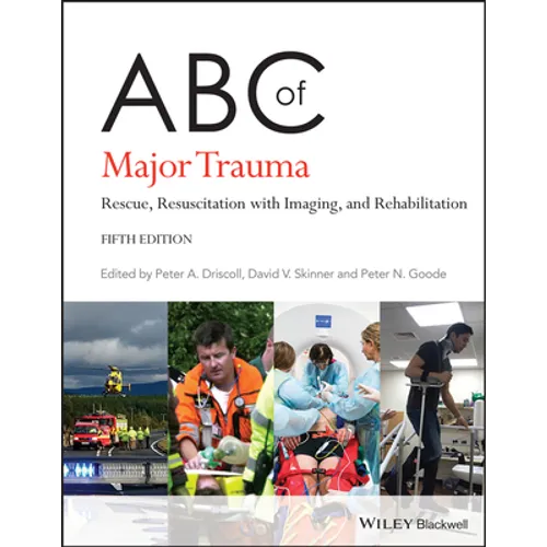 ABC of Major Trauma: Rescue, Resuscitation with Imaging, and Rehabilitation - Paperback