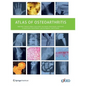 Atlas of Osteoarthritis - Paperback