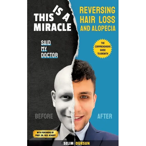 This Is a Miracle Said My Doctor: Reversing Hair Loss and Alopecia - Paperback
