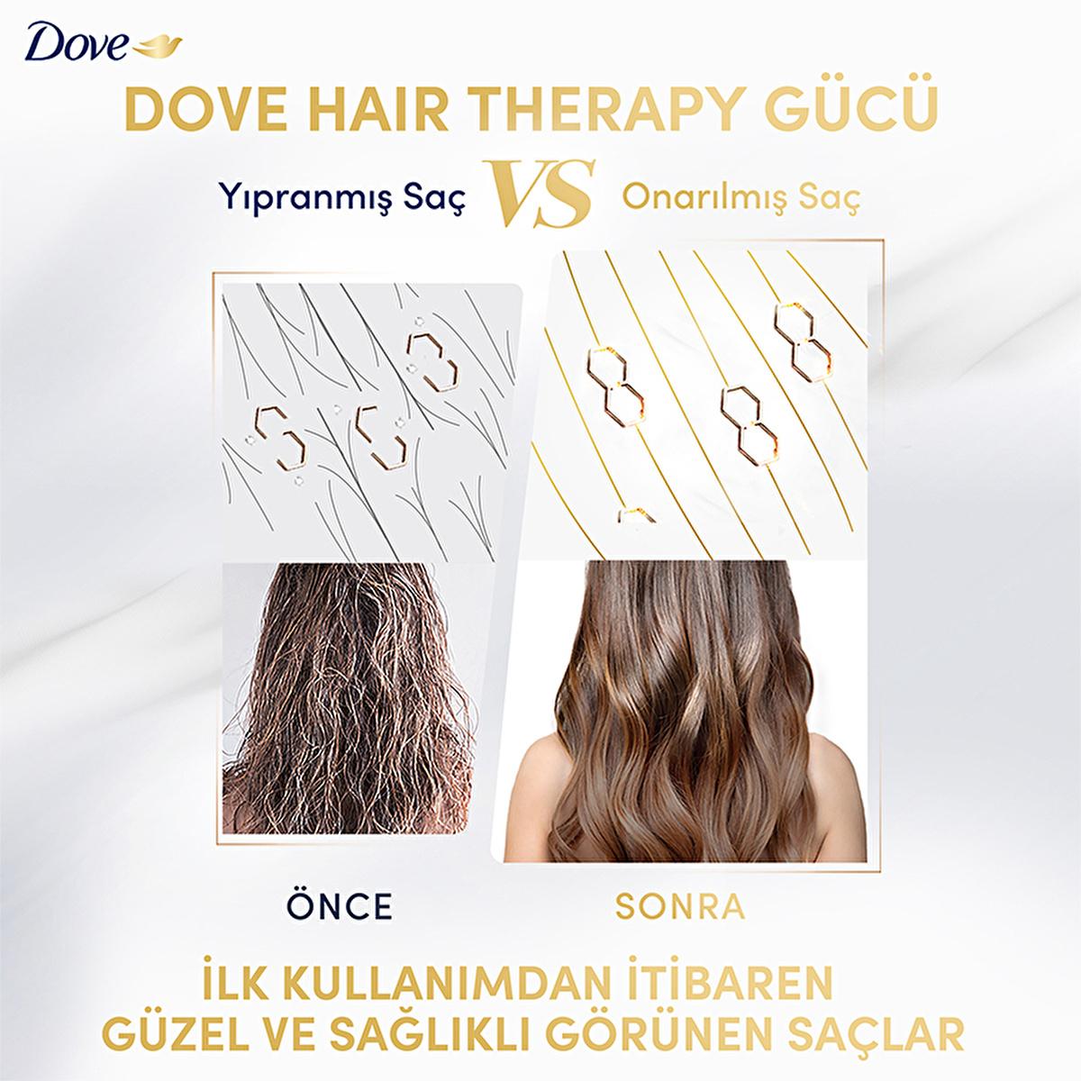 Dove Hair Therapy Breakage Remedy Shampoo - Nourishing, Anti-Breakage Hair Care for Damaged, Fragile Hair