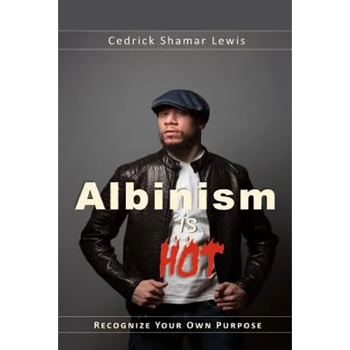 Albinism is Hot! - Paperback