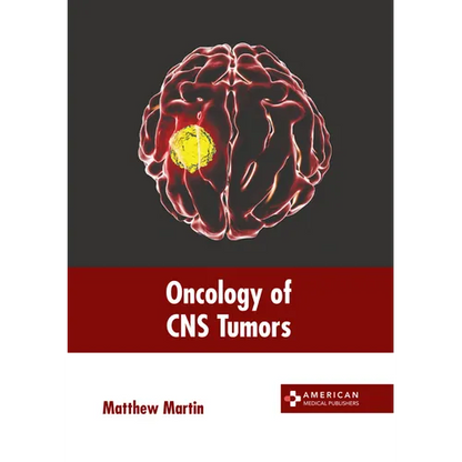 Oncology of CNS Tumors - Hardcover