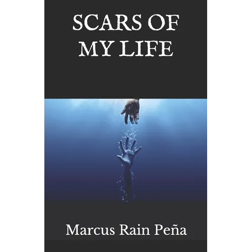 Scars of my Life - Paperback